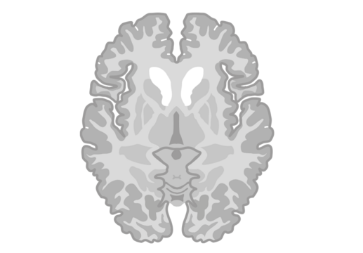 Hjernen illustreret ved horisontalsnit